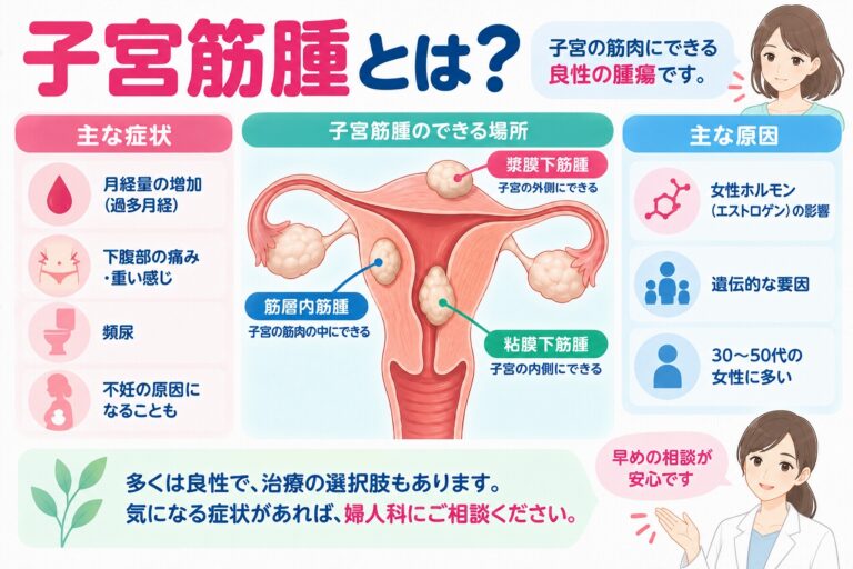 子宮筋腫の種類や症状を解説したインフォグラフィック。子宮の筋肉にできる良性腫瘍について、漿膜下筋腫・筋層内筋腫・粘膜下筋腫のできる場所と、過多月経、下腹部の痛みや圧迫感、頻尿、不妊などの主な症状を紹介