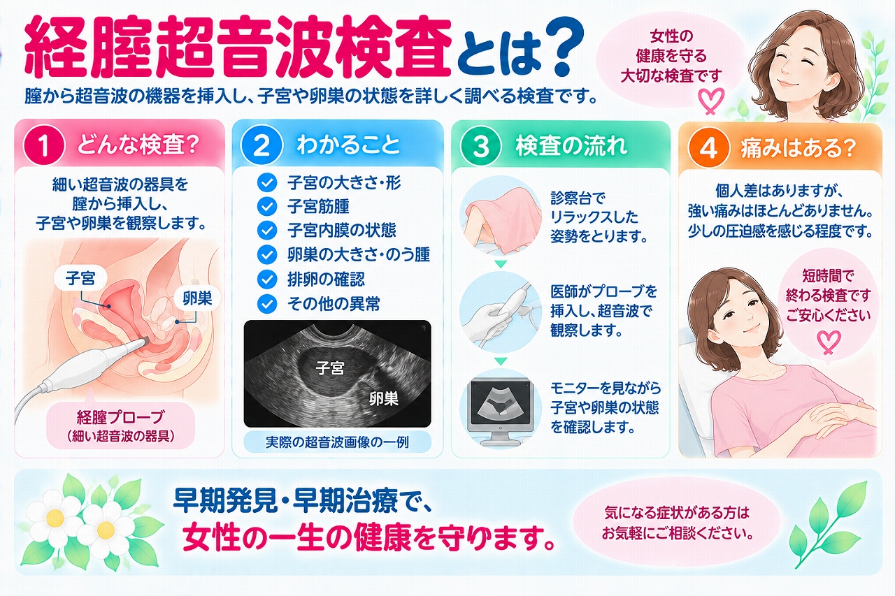 経腟超音波検査について解説したインフォグラフィック。細い超音波プローブを腟内に挿入して子宮や卵巣を観察する検査について、子宮や卵巣の大きさ・形、子宮内膜、子宮筋腫や卵巣のう腫などの確認、検査の流れや痛みについて紹介