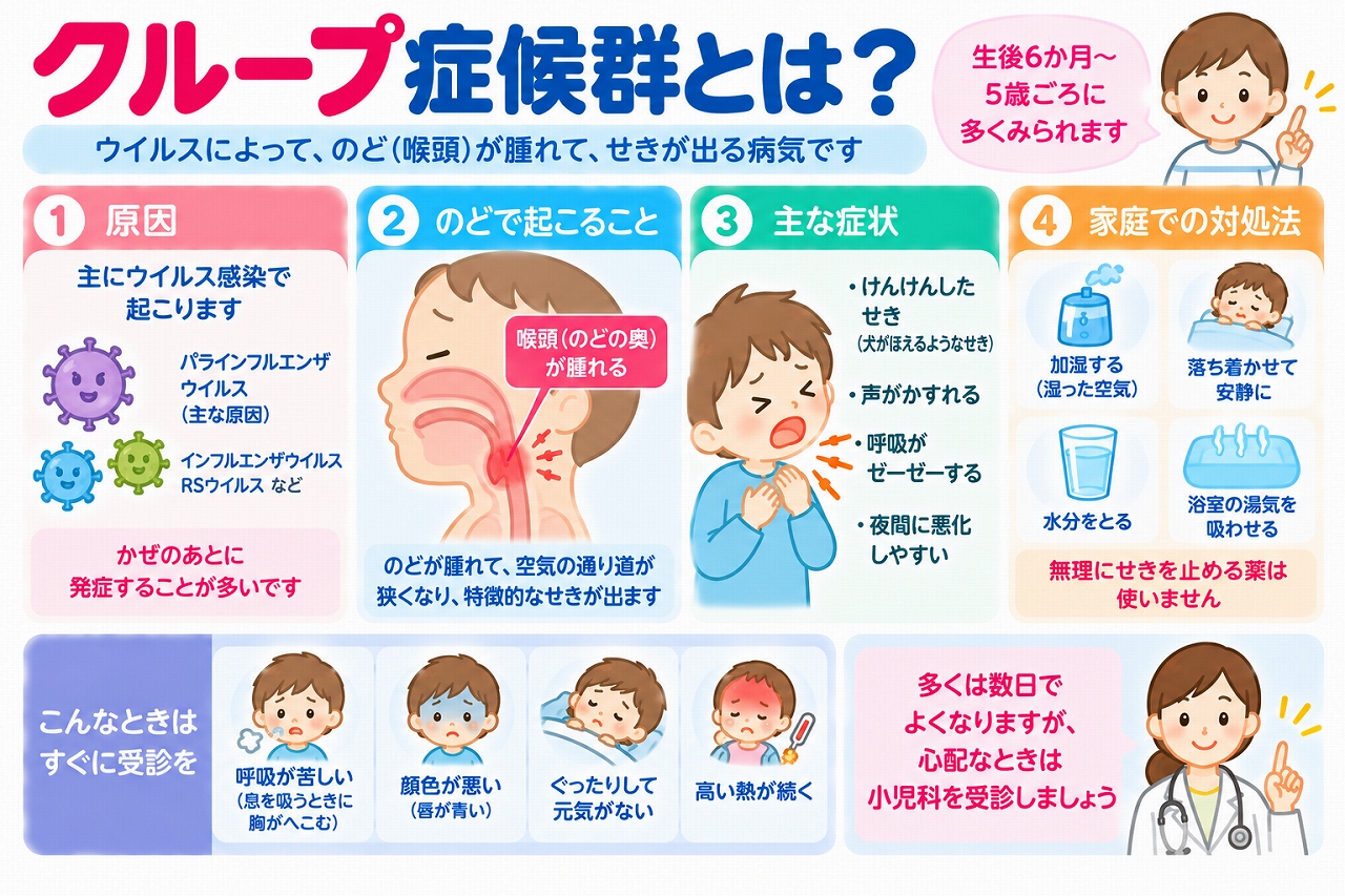 子どものクループ症候群の原因や症状、家庭での対処法を解説した医療インフォグラフィック。ウイルス感染によって喉頭や気管の上部が腫れ、気道が狭くなる仕組みを図解。犬が吠えるような咳、声がれ、吸気性喘鳴、夜間の症状悪化などの特徴と、安静、水分補給、呼吸困難や顔色不良などの緊急受診の目安を紹介。