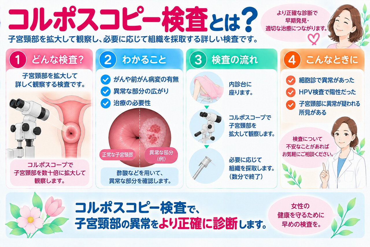 コルポスコピー検査について解説したインフォグラフィック。子宮頸部を拡大して観察し、異常が疑われる部分を確認する検査について、検査の目的や流れ、細胞診やHPV検査で異常がみられた場合の精密検査、必要に応じて行う組織診について紹介