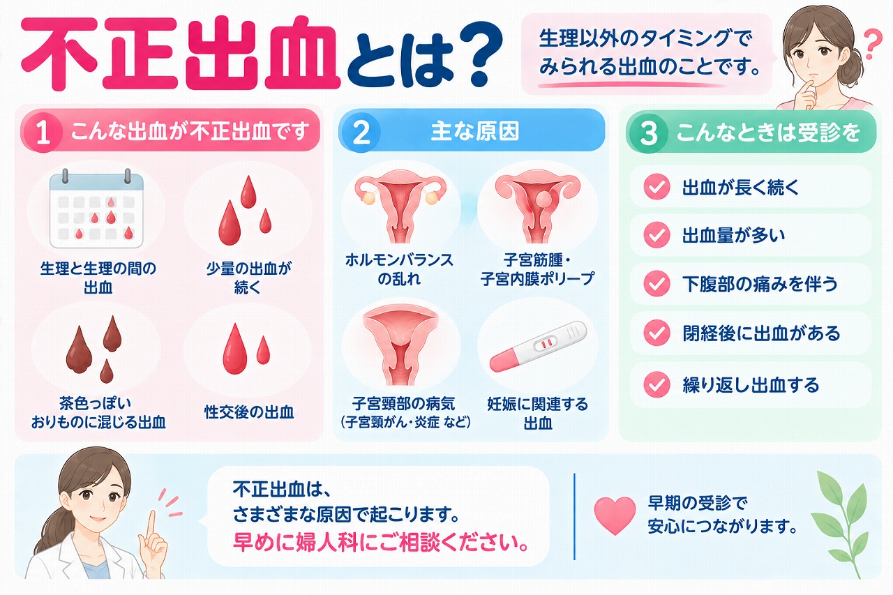 不正出血の症状や原因を解説したインフォグラフィック。生理と生理の間の出血、少量の出血、茶色いおりものに混じる出血、性交後の出血などの特徴と、ホルモンバランスの乱れ、子宮筋腫・子宮内膜ポリープ、子宮頸部の病気、妊娠に関連する出血などを紹介