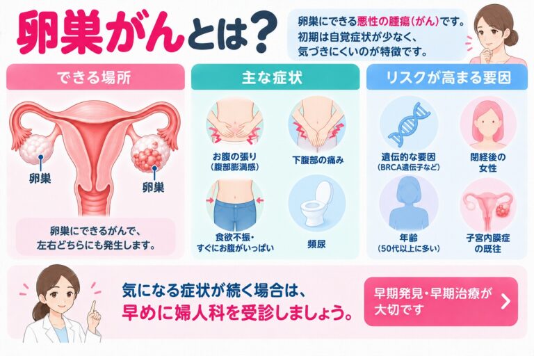 卵巣がんの特徴や症状、リスク因子を解説したインフォグラフィック。卵巣に発生する悪性腫瘍について、お腹の張り、下腹部痛、食欲不振、すぐに満腹になる、頻尿などの症状と、遺伝的要因や年齢、子宮内膜症などとの関連を紹介