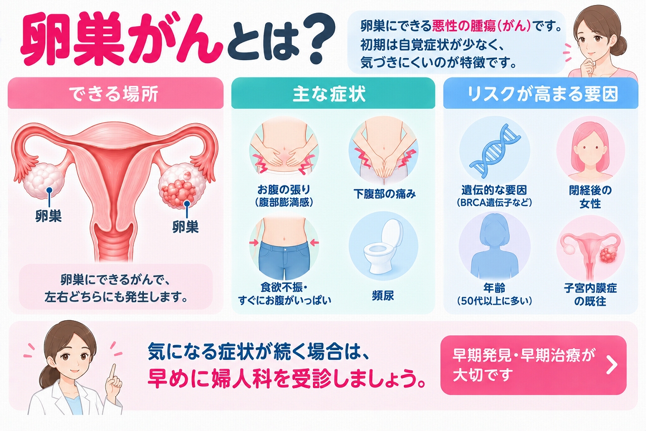 卵巣がんの特徴や症状、リスク因子を解説したインフォグラフィック。卵巣に発生する悪性腫瘍について、お腹の張り、下腹部痛、食欲不振、すぐに満腹になる、頻尿などの症状と、遺伝的要因や年齢、子宮内膜症などとの関連を紹介
