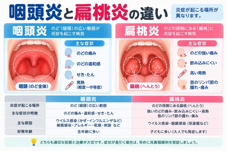 咽頭炎と扁桃炎の違い｜炎症が起こる場所・症状・原因を比較