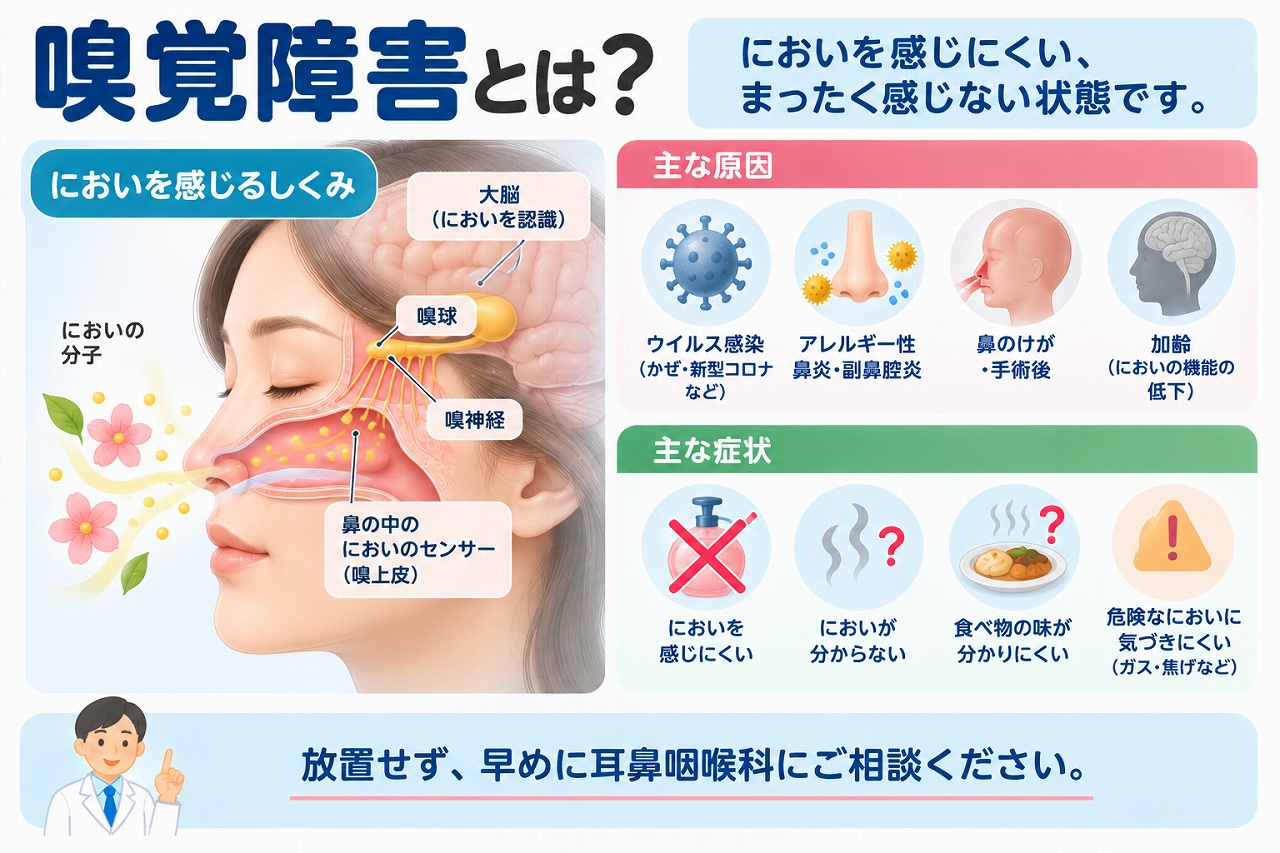 嗅覚障害の原因や症状を解説したインフォグラフィック。においの分子を嗅上皮で感知し、嗅神経から脳へ伝える仕組みと、ウイルス感染、アレルギー性鼻炎・副鼻腔炎、鼻のけが、加齢などによって嗅覚が低下する原因を紹介