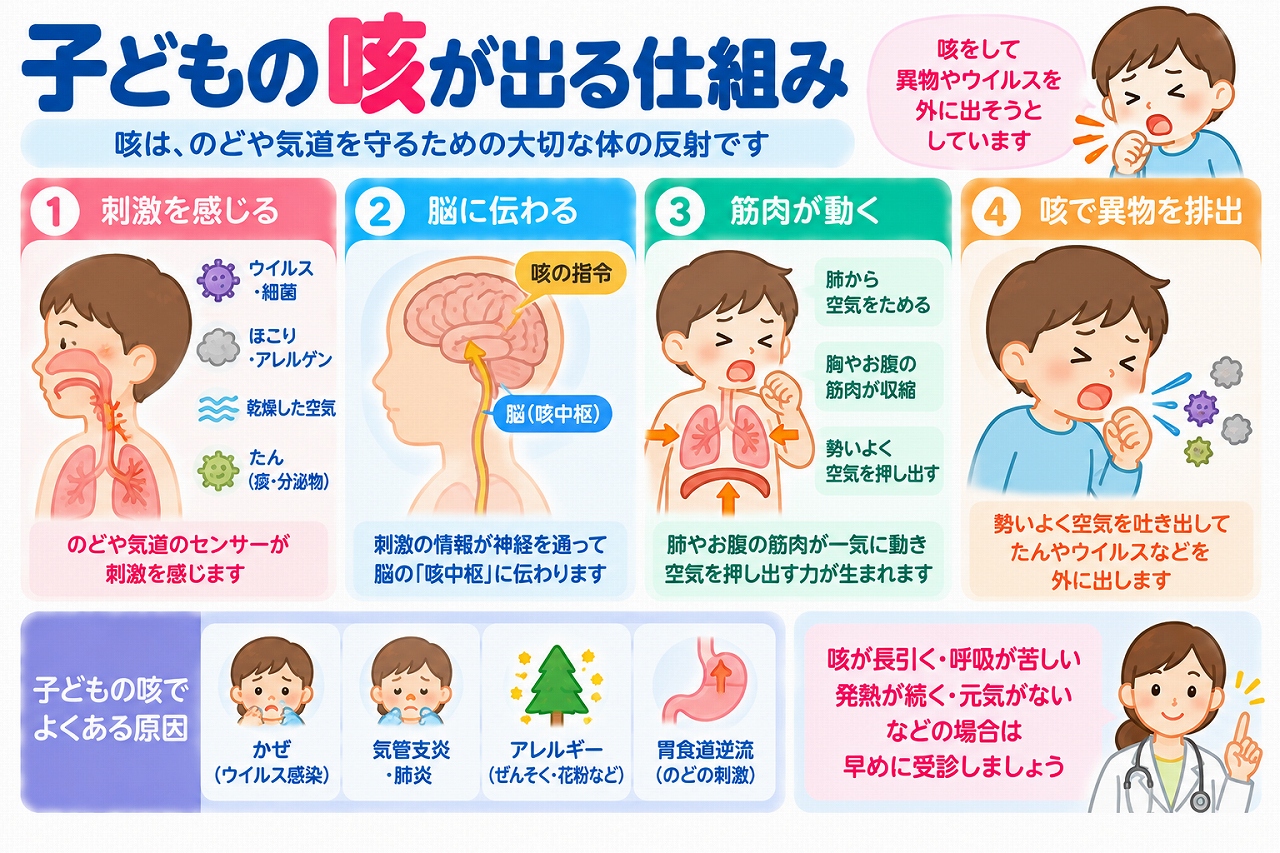 子どもの咳が出る仕組みを解説した医療インフォグラフィック。ウイルスやほこり、痰などが気道を刺激し、その情報が神経を通って脳の咳中枢に伝わり、呼吸筋が働いて咳が出るまでを4段階で図解。風邪、気管支炎、肺炎、アレルギー、胃食道逆流などの原因と、呼吸困難や長引く咳などの受診の目安を紹介。