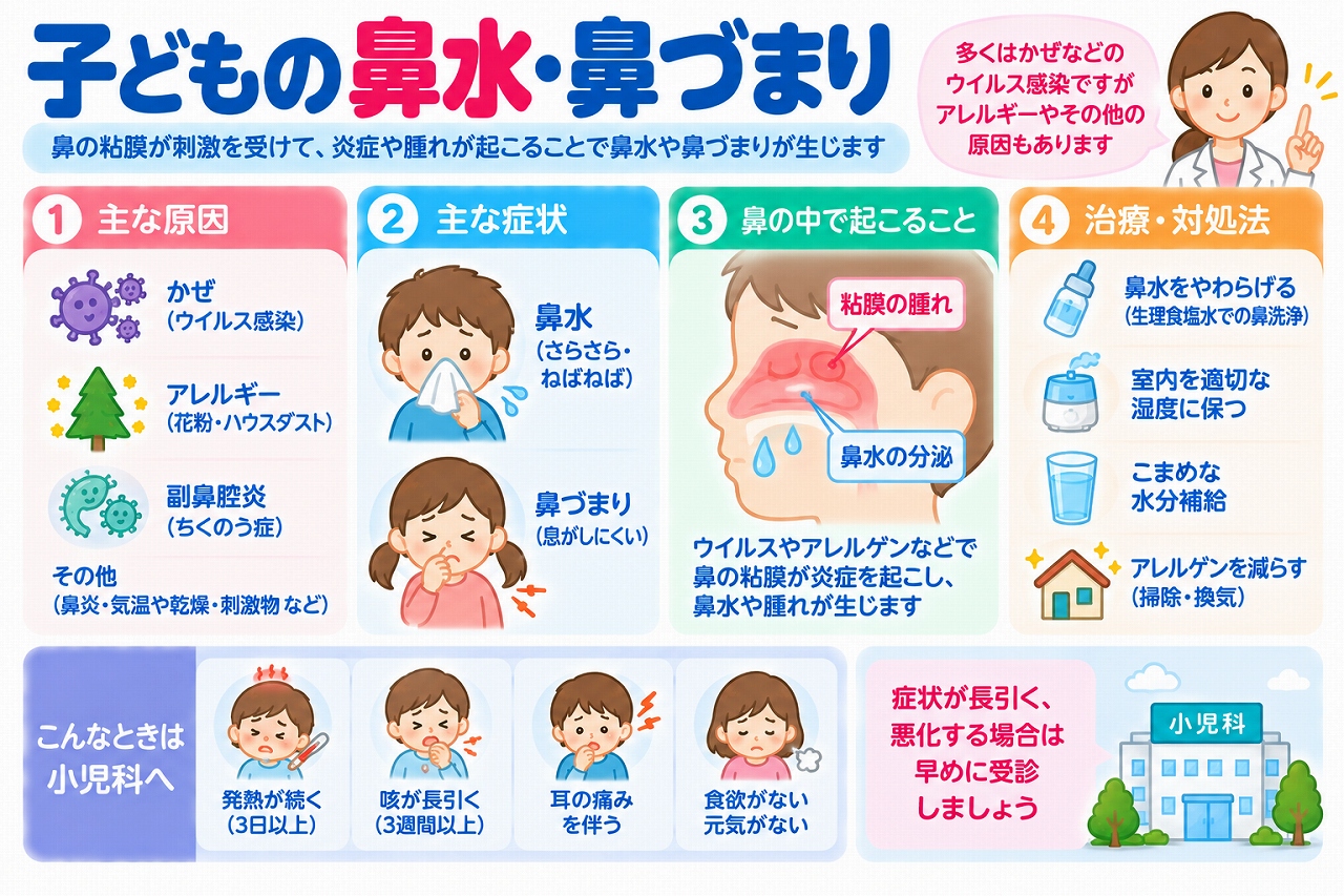 子どもの鼻水・鼻づまりの原因や症状、家庭での対処法を解説した医療インフォグラフィック。風邪、アレルギー、副鼻腔炎などの原因と、鼻の粘膜が炎症を起こして鼻水が増えたり、粘膜が腫れて鼻づまりが生じたりする仕組みを図解。生理食塩水による鼻のケア、適切な加湿、水分補給、アレルゲン対策、受診の目安を紹介。