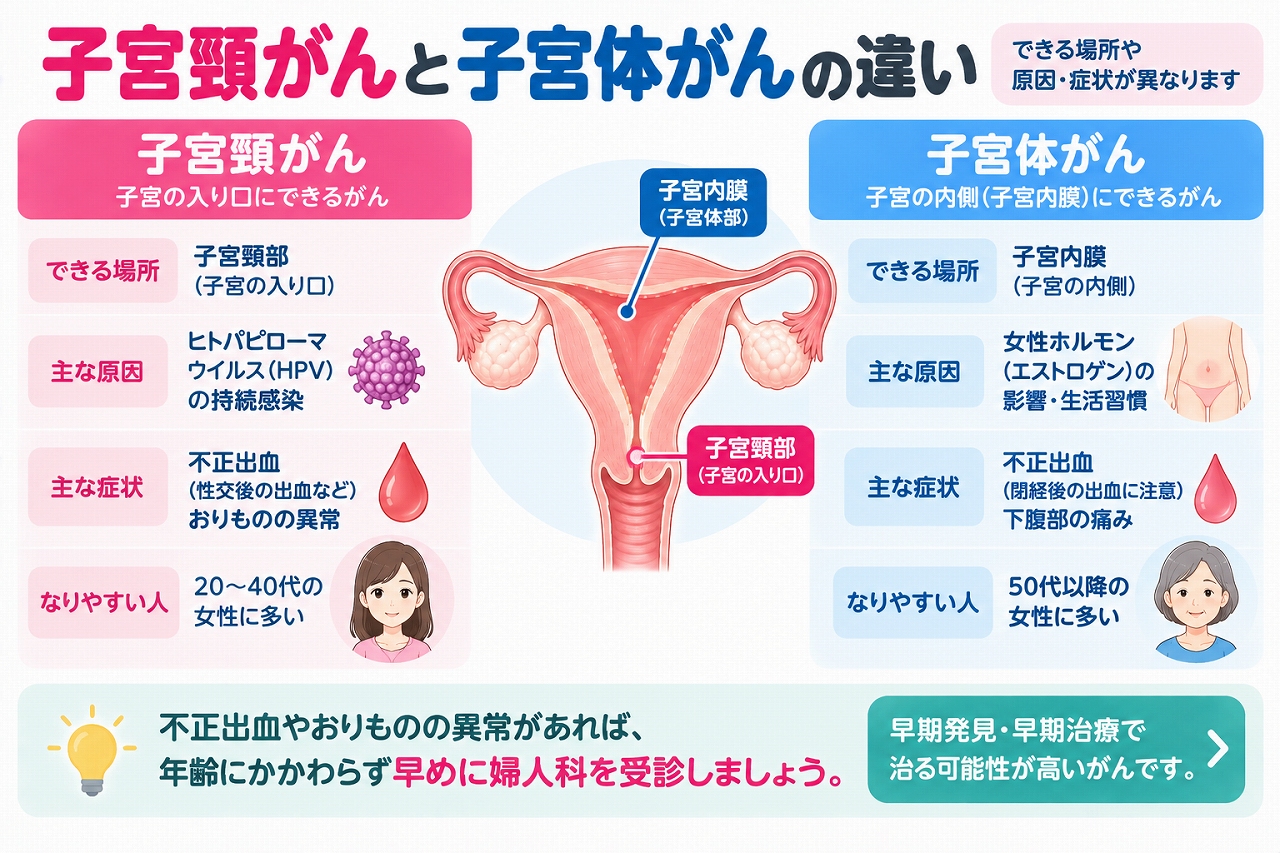 子宮頸がんと子宮体がんの違いを比較したインフォグラフィック。子宮頸部に発生しHPVの持続感染が主な原因となる子宮頸がんと、子宮内膜に発生する子宮体がんについて、できる場所、原因、主な症状、発症しやすい年代などの違いを紹介