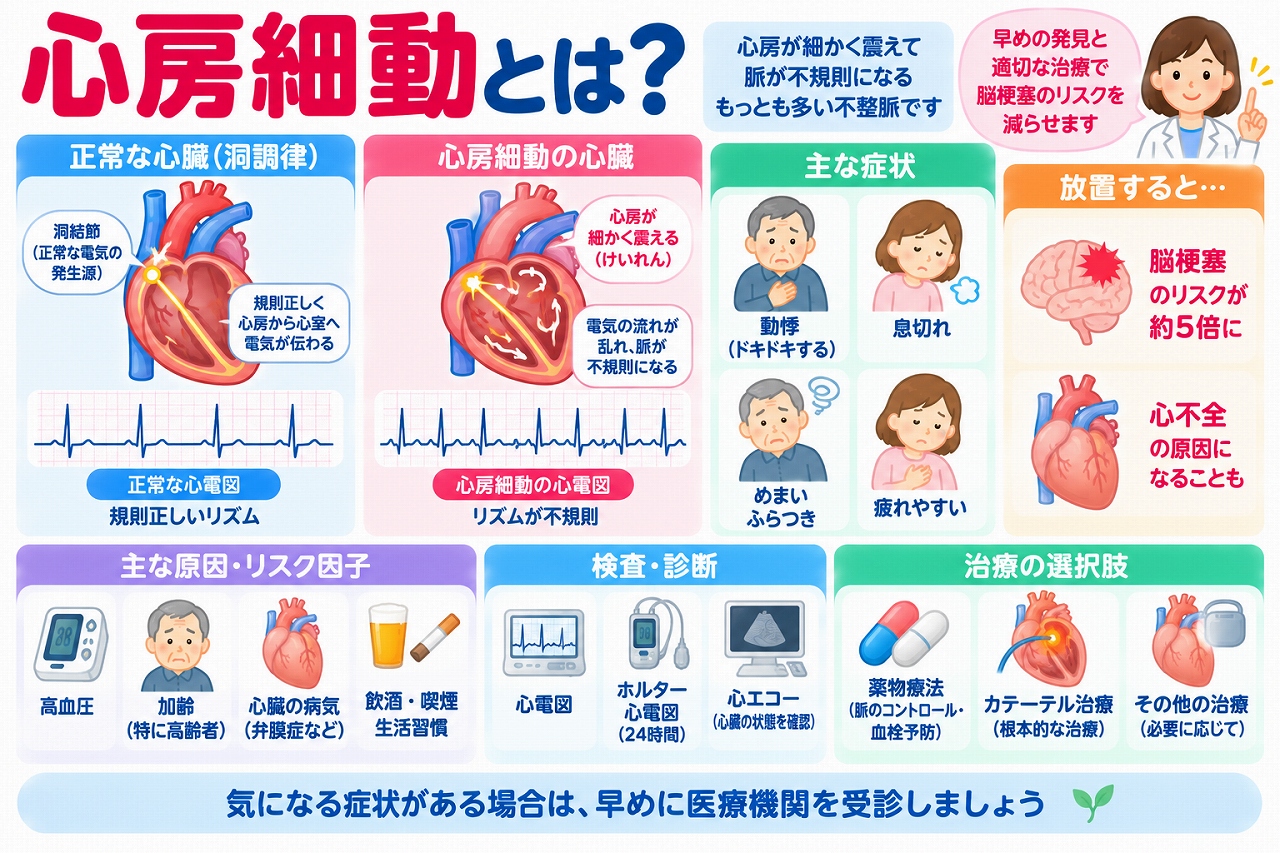 心房細動の仕組みや症状、原因、検査・治療法を解説した医療インフォグラフィック。正常な心臓と心房細動の心臓を比較し、電気信号の乱れによる不規則な脈と心電図の違いを紹介。動悸、息切れ、めまい、疲労感などの症状、脳梗塞や心不全のリスク、心電図検査、抗凝固薬、カテーテルアブレーションなどの治療法を図解。