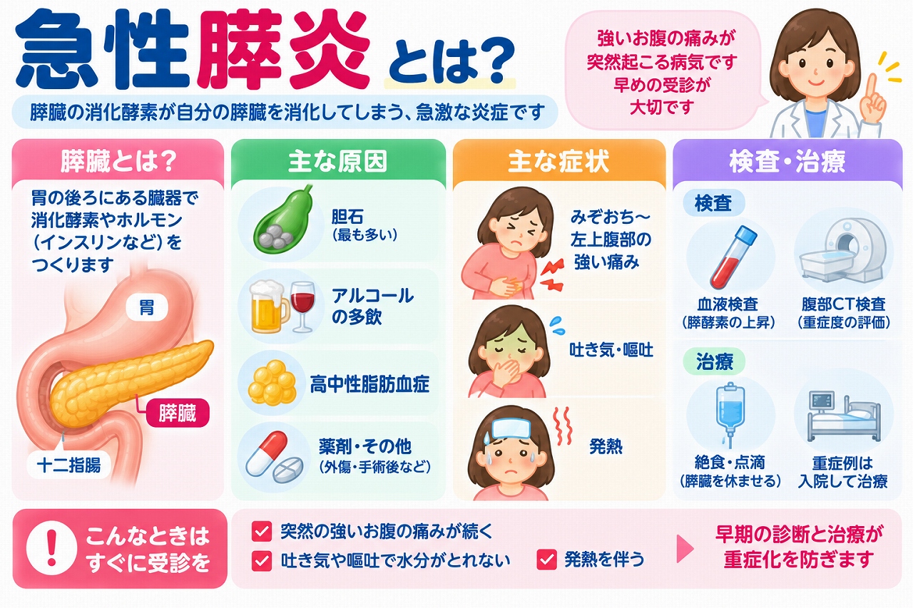 急性膵炎の原因や症状、検査・治療法を解説した医療インフォグラフィック。膵臓の位置と働き、胆石、過度の飲酒、高中性脂肪血症などの原因を紹介。みぞおちから左上腹部の強い痛み、吐き気、嘔吐、発熱などの症状と、血液検査、腹部CT検査、点滴、入院治療などを図解。重症化を防ぐための早期受診の重要性も説明。