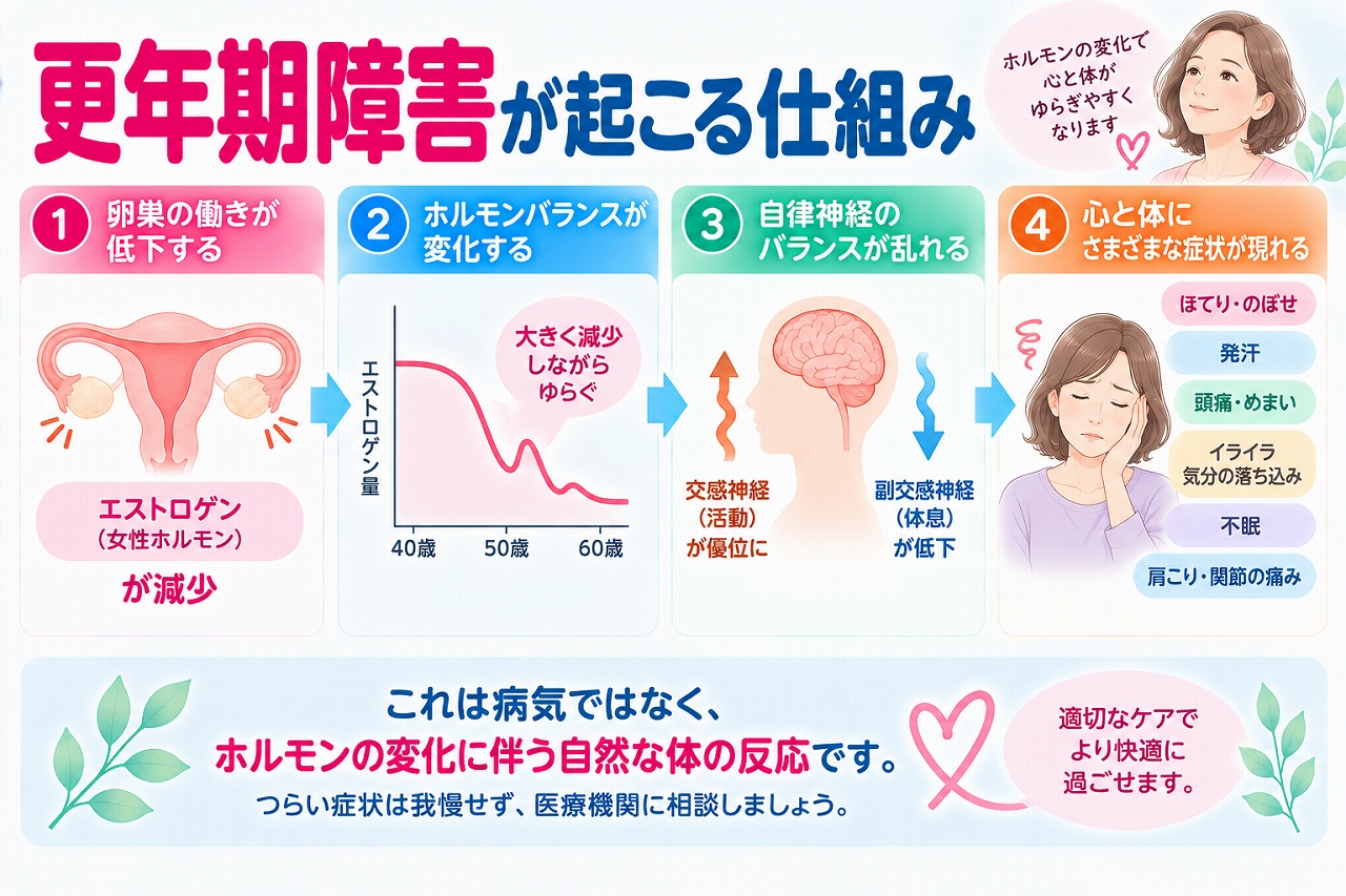 更年期障害が起こる仕組みを解説したインフォグラフィック。卵巣機能の低下に伴って女性ホルモン（エストロゲン）が大きく変動しながら減少し、自律神経などに影響することで、ほてり・発汗・頭痛・めまい・不眠・気分の変化などが現れる流れを紹介