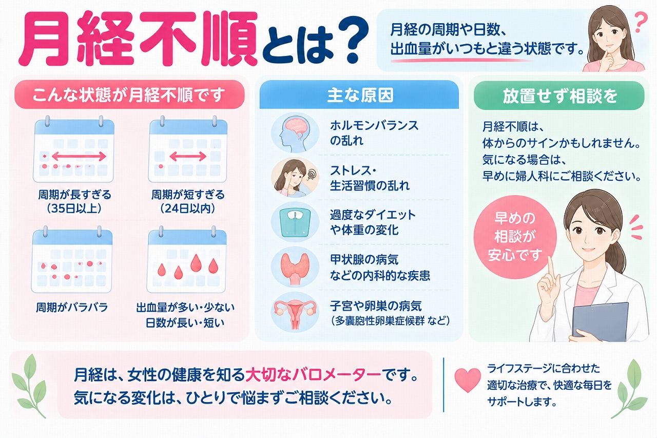 月経不順の状態や原因を解説したインフォグラフィック。月経周期が長い・短い・ばらつく、出血量や月経日数がいつもと異なるなどの変化と、ホルモンバランス、ストレス、体重変化、甲状腺疾患、子宮・卵巣の病気など主な原因を紹介
