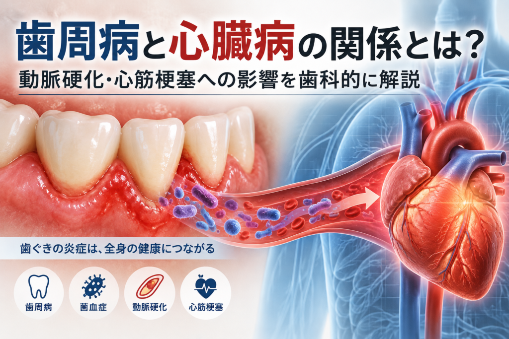 歯周病と心臓病の関係｜動脈硬化・心筋梗塞への影響