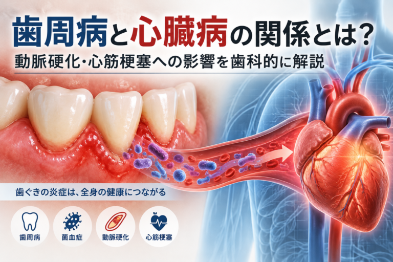歯周病による歯ぐきの炎症と心臓病の関係を示した医療イラスト。歯周病菌が血流に入り込む菌血症の仕組みと、動脈硬化・心筋梗塞との関連を解説。
