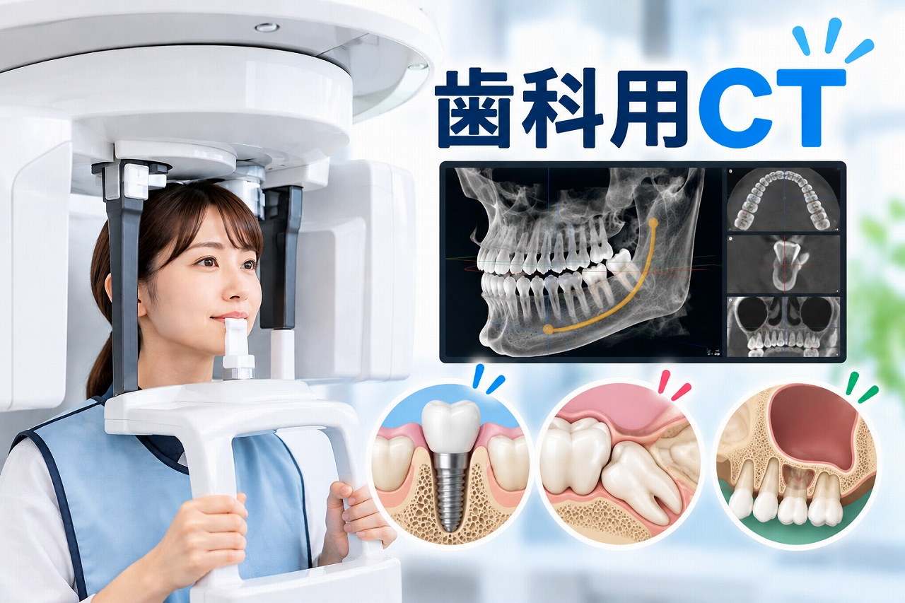 歯科用CT（コーンビームCT）の仕組みとレントゲンとの違いを解説した歯科医療インフォグラフィック。歯科用CT装置で撮影する女性、従来のパノラマレントゲンによる2次元画像、歯科用CTによる3次元画像を比較。インプラント治療、埋伏した親知らず、上顎洞と歯根の位置関係を示す模式図を配置し、立体的な画像診断の特徴を紹介している。