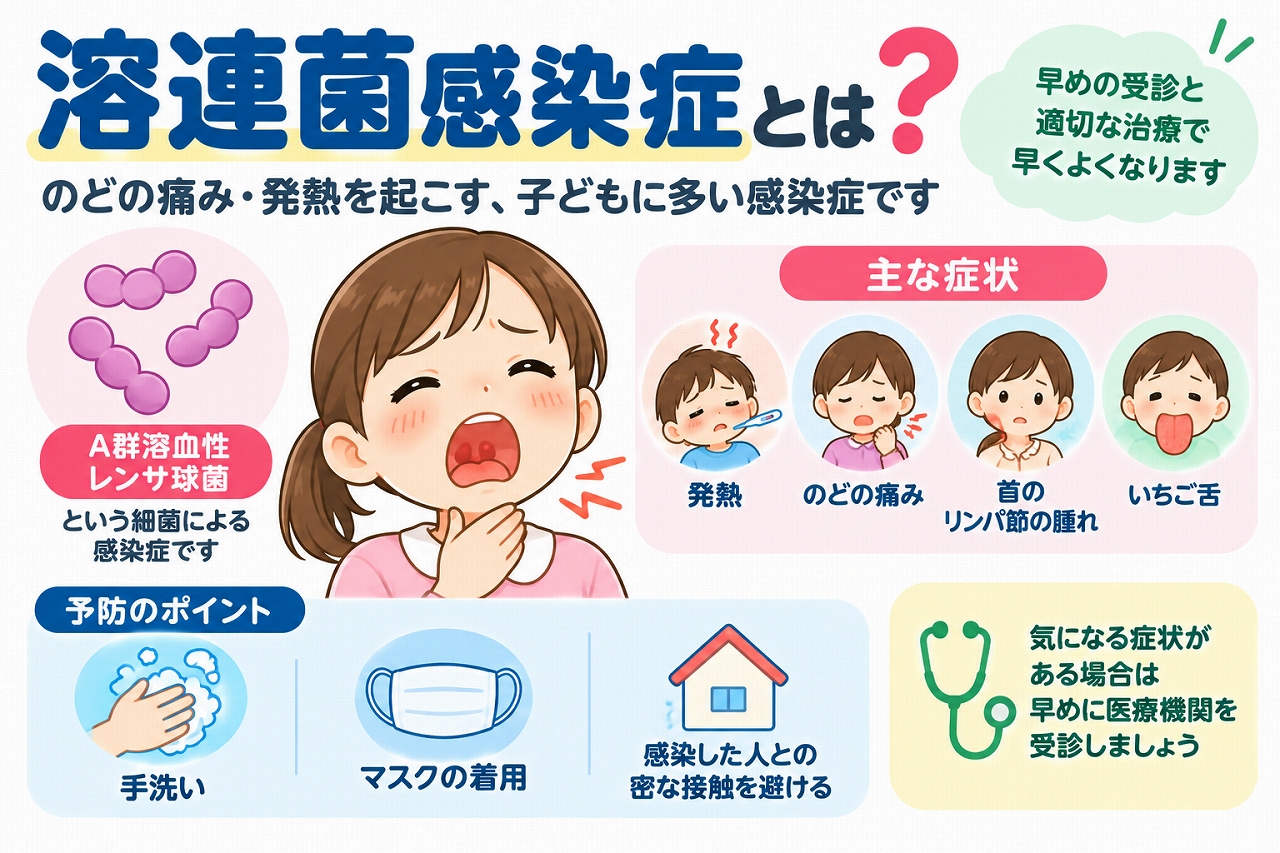 溶連菌感染症の原因や主な症状、予防方法を解説した医療インフォグラフィック。A群溶血性レンサ球菌による感染と、発熱、のどの痛み、首のリンパ節の腫れ、いちご舌などの症状をイラストで紹介。手洗い、マスクの着用、感染者との密接な接触を避けるなどの予防対策と、早期受診の重要性を図解。