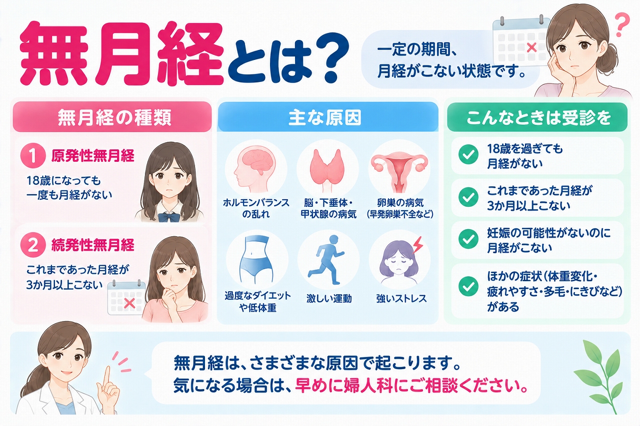 無月経の種類や原因、受診の目安を解説したインフォグラフィック。原発性無月経と続発性無月経の違いや、ホルモンバランス、卵巣・甲状腺などの病気、過度なダイエット、激しい運動、ストレスなど月経がこなくなる主な原因を紹介