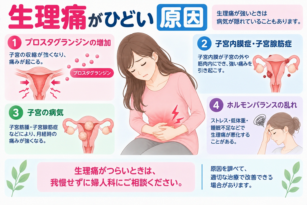 生理痛がひどくなる原因を解説したインフォグラフィック。プロスタグランジンによる強い子宮収縮や、子宮内膜症、子宮腺筋症、子宮筋腫などの病気、体調やストレスなど、生理痛が強くなる主な原因を紹介