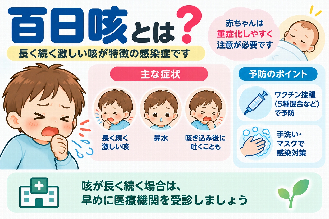 百日咳の主な症状と予防方法を解説した医療インフォグラフィック。激しい咳が長く続く子どものイラストとともに、発作的な咳、鼻水、咳き込んだ後の嘔吐などの症状を紹介。乳児では重症化しやすいことや、5種混合ワクチンなどの予防接種、手洗い、マスクによる感染対策の重要性を図解。