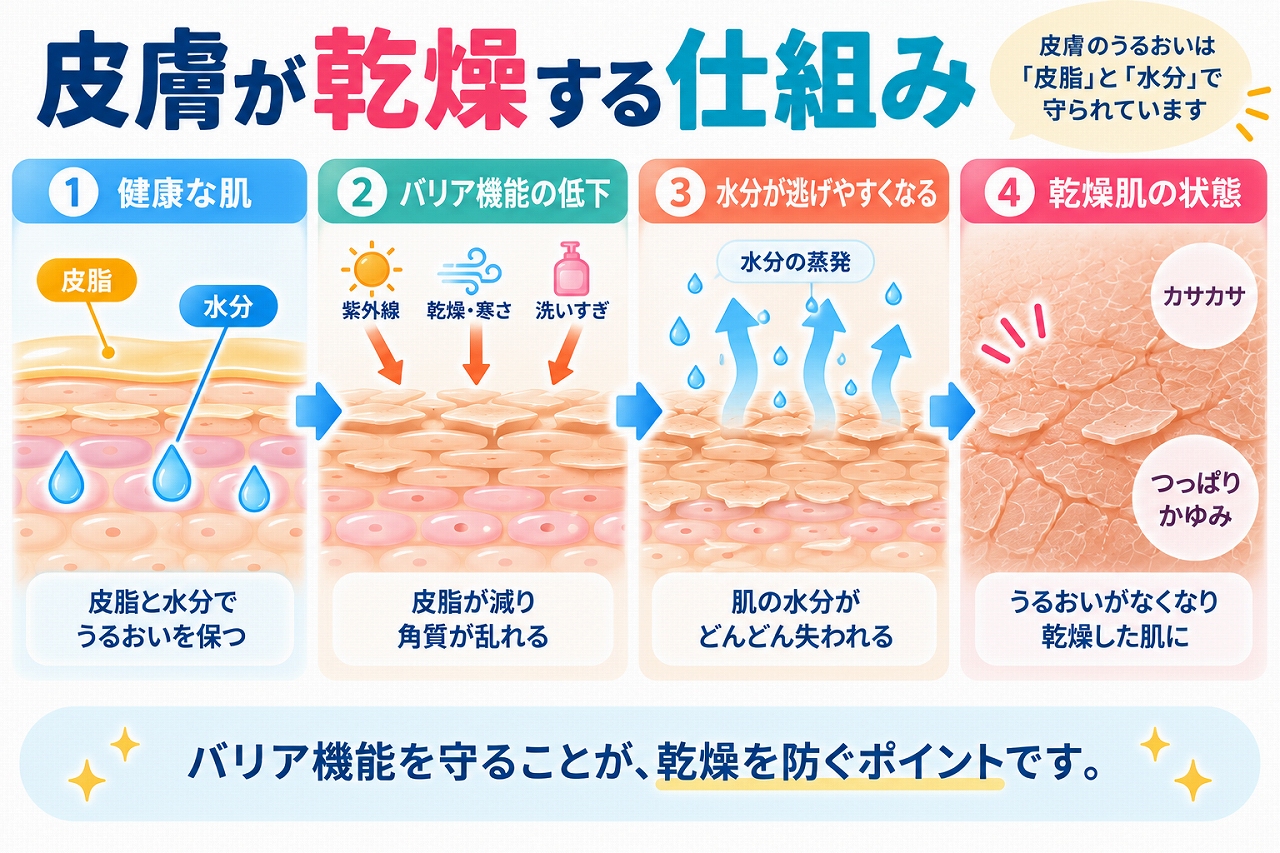 皮膚が乾燥する仕組みを、健康な肌では皮脂や角質層が水分を保つのに対し、紫外線・乾燥・寒さ・洗いすぎなどでバリア機能が低下すると水分が蒸発し、カサつきやつっぱり、かゆみが現れる流れで示した図
