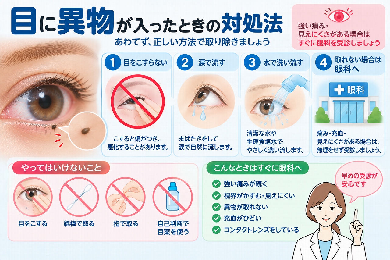 目に異物が入ったときの対処法を解説したインフォグラフィック。目をこすらず、まばたきや涙で流し、清潔な水や生理食塩水で洗い流す方法と、異物が取れない場合や痛み・充血・見えにくさが続く場合の受診目安を紹介