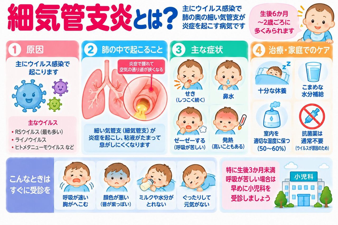 乳幼児の細気管支炎の原因や症状、治療・家庭でのケアを解説した医療インフォグラフィック。RSウイルスなどの感染によって細気管支に炎症が起こり、粘膜の腫れや分泌物で気道が狭くなる仕組みを図解。咳、鼻水、ゼーゼーする呼吸、発熱などの症状と、休養、水分補給、呼吸困難や哺乳不良などの緊急受診の目安を紹介。