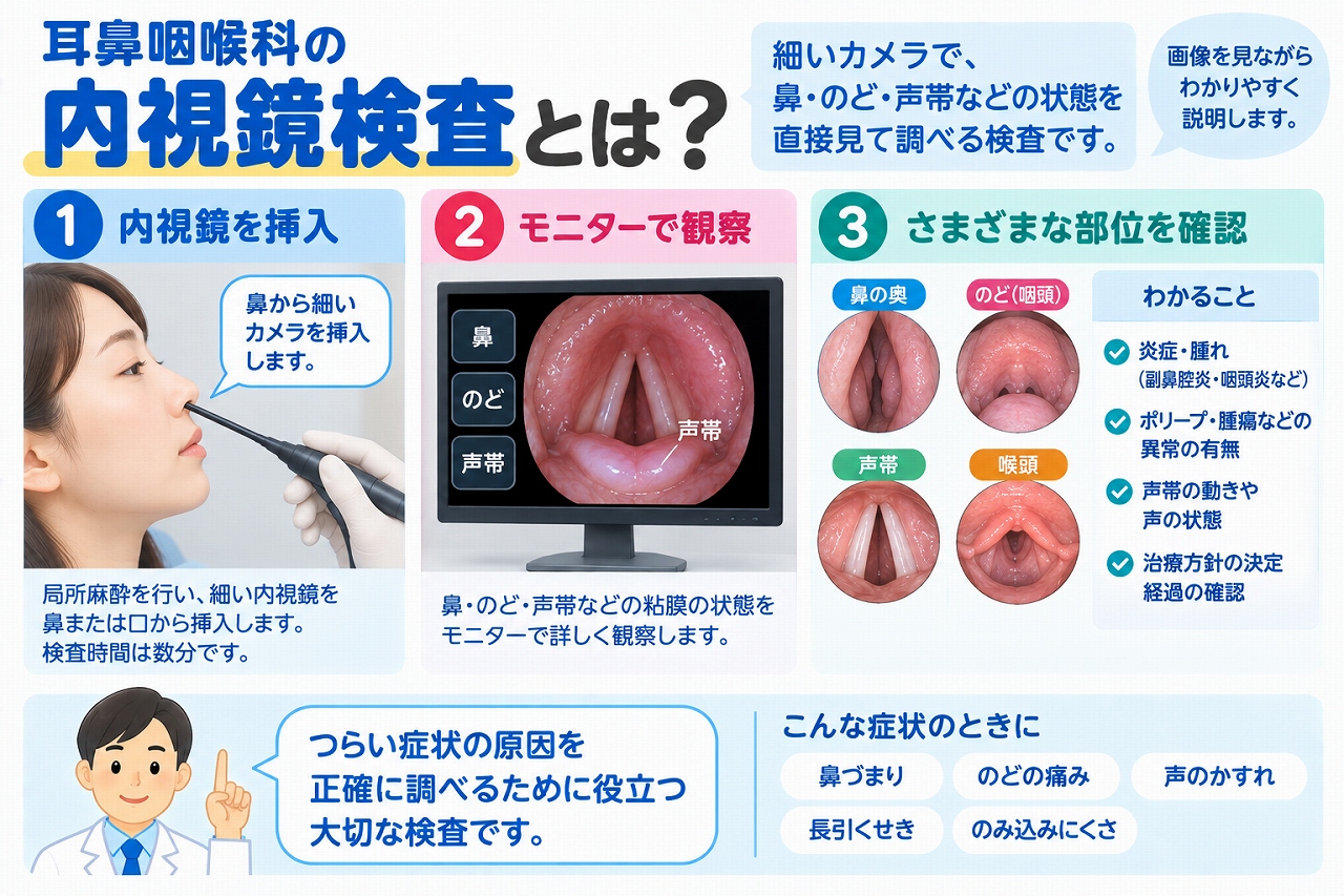 耳鼻咽喉科の内視鏡検査を解説したインフォグラフィック。細い内視鏡を鼻や口から挿入し、鼻腔・咽頭・喉頭・声帯などをモニターで観察して、炎症や腫れ、ポリープ、腫瘍、声帯の動きなどを確認する検査の流れを紹介