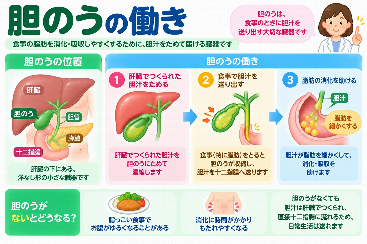 胆のうの位置や働き、胆汁による脂肪の消化・吸収の仕組みを解説した医療インフォグラフィック。肝臓で作られた胆汁を胆のうに蓄えて濃縮し、食事に合わせて十二指腸へ送り出す3段階の流れを紹介。胆汁が脂肪を細かく分散させる働きや、胆のう摘出後の消化機能についても図解。