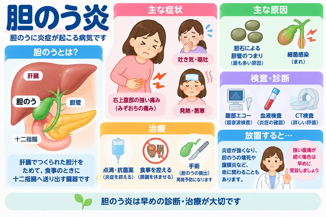 胆のう炎の原因や症状、検査、治療法を解説した医療インフォグラフィック。胆石による胆のう管の閉塞や胆のうの炎症、右上腹部の強い痛み、吐き気、嘔吐、発熱などの症状を紹介。腹部エコー、血液検査、CT検査による診断と、点滴、抗菌薬、胆のう摘出術などの治療法、早期受診の重要性を図解。