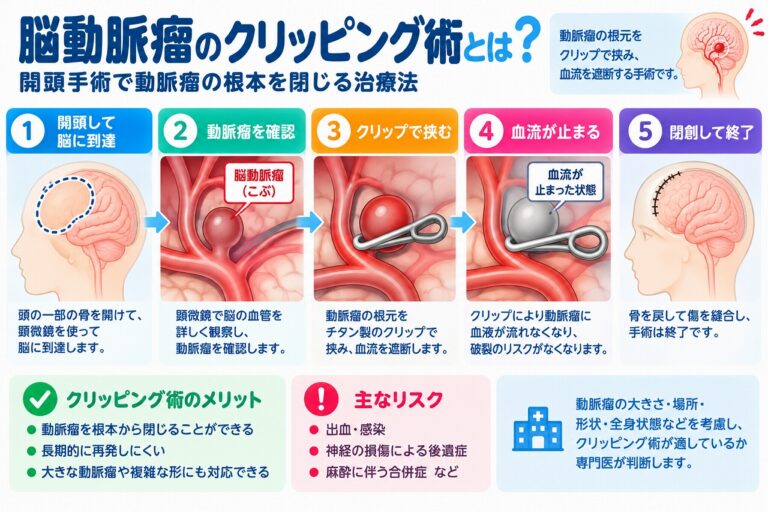脳動脈瘤のクリッピング術とは？開頭手術の仕組み・手順・メリットとリスクを図解