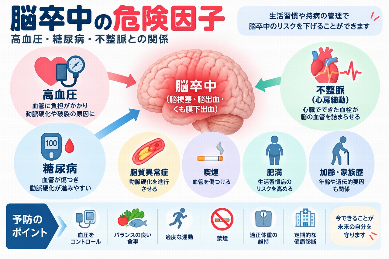 脳卒中の主な危険因子を解説した医療インフォグラフィック。高血圧、糖尿病、心房細動などの不整脈、脂質異常症、喫煙、肥満、加齢、家族歴と脳梗塞・脳出血・くも膜下出血の関係を図解。血圧管理、食生活の改善、運動、禁煙、適正体重の維持などの予防方法も紹介。