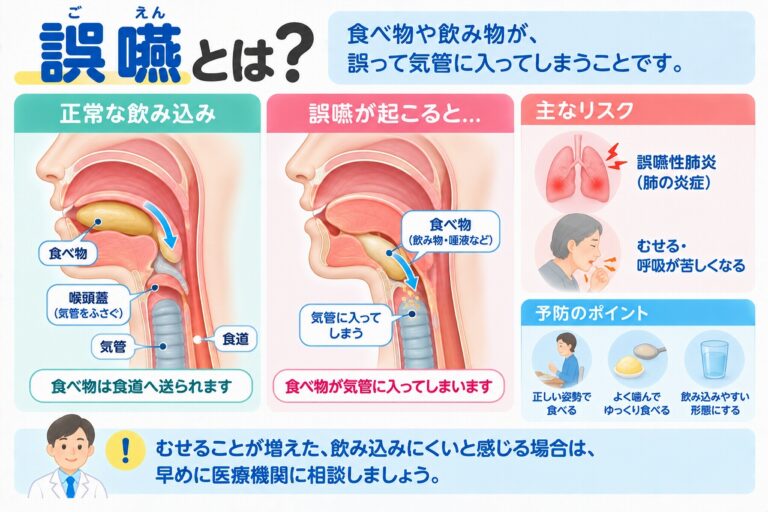 誤嚥の仕組みやリスクを解説したインフォグラフィック。正常な嚥下では食べ物が食道へ送られるのに対し、誤嚥では食べ物や飲み物、唾液などが誤って気管に入り、むせや誤嚥性肺炎につながることや予防のポイントを紹介