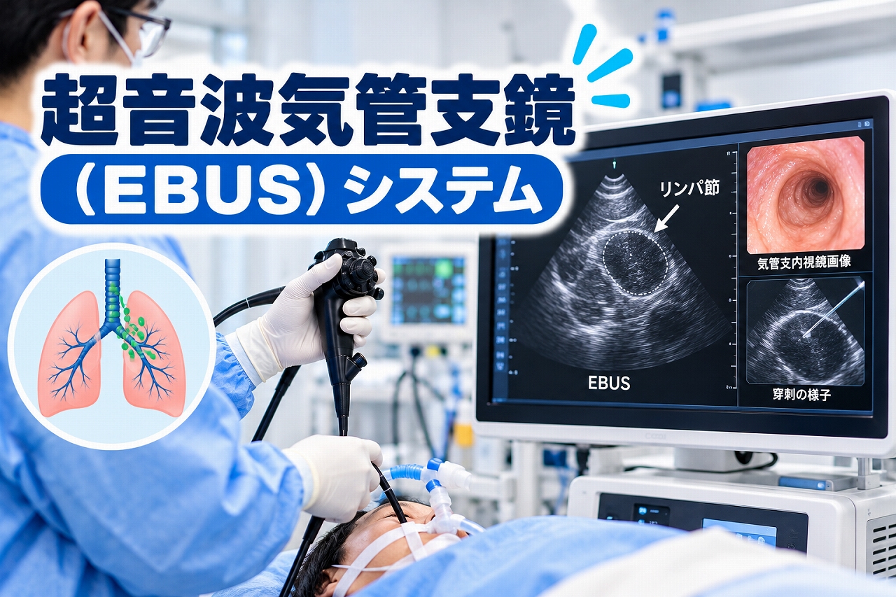 超音波気管支鏡(EBUS)システムの医療用アイキャッチ画像。医師が気管支鏡を操作し、モニターに気管支内部の内視鏡画像と超音波によるリンパ節の断面画像を表示している。肺と気管支の模式図や超音波ガイド下での穿刺イメージを組み合わせ、肺がん診断やリンパ節の組織採取に使用する医療機器を紹介している。