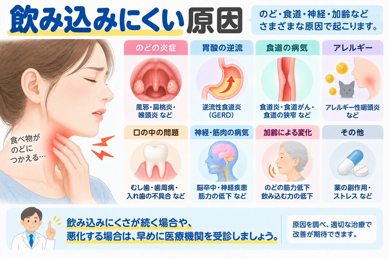 飲み込みにくい原因を解説したインフォグラフィック。のどの炎症、胃酸の逆流、食道の病気、アレルギー、口の中の問題、神経・筋肉の病気、加齢による嚥下機能の低下など、食べ物を飲み込みにくくなる主な原因を紹介