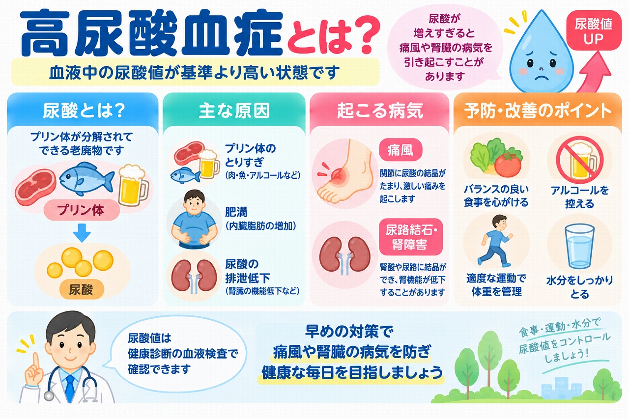 高尿酸血症の原因や症状、関連する病気、予防法を解説した医療インフォグラフィック。プリン体の分解によって尿酸が作られる仕組みと、食生活、飲酒、肥満、腎臓からの尿酸排泄低下などの原因を紹介。尿酸値の上昇によって起こる痛風、尿路結石、腎障害などのリスクと、食事の改善、節酒、適度な運動、水分補給などの対策を図解。
